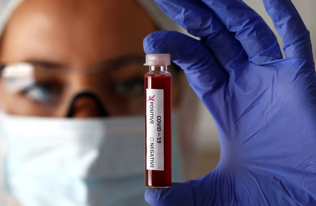 La sangre de recuperados de Covid-19 puede usarse como tratamiento para erradicarlo: en México ya evalúan aplicarlo