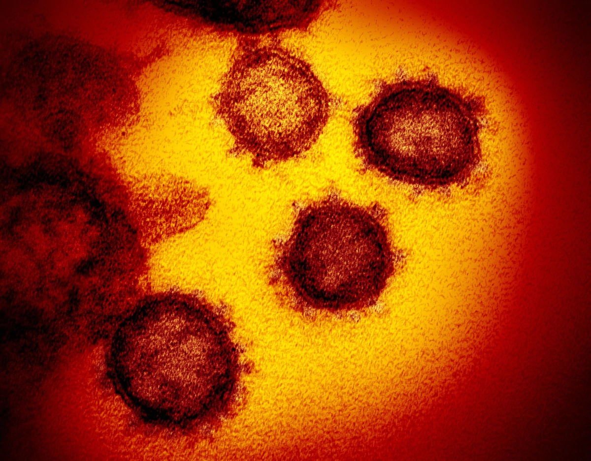 Las infecciones de coronavirus con altas cargas virales deben resultarnos más preocupantes