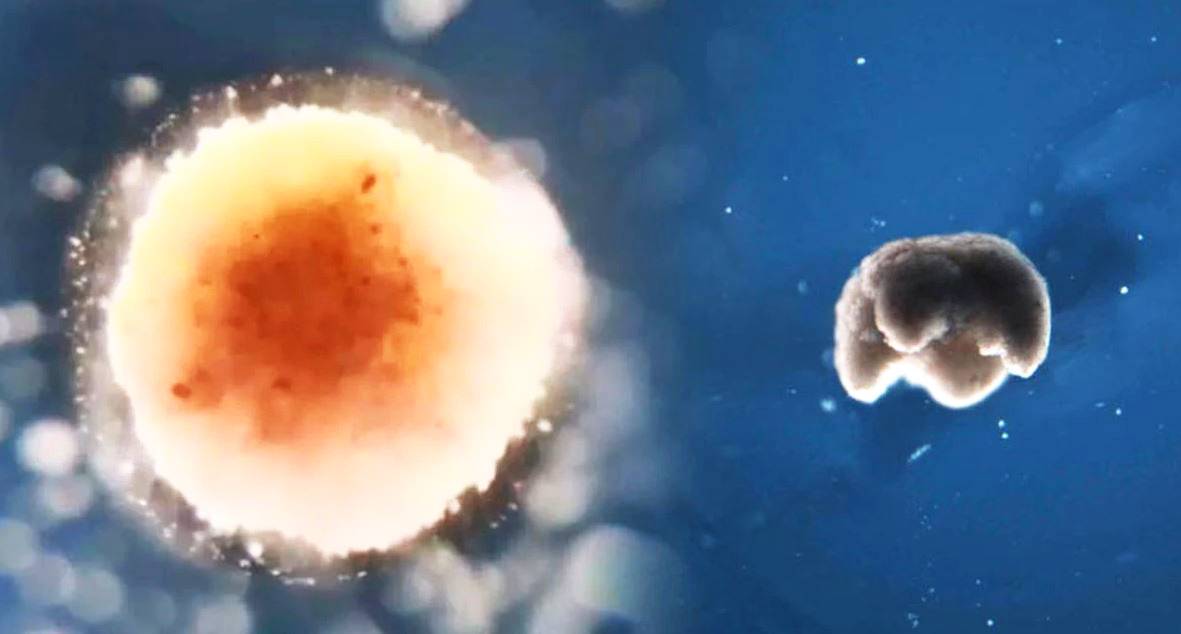 Salud: científicos descubren posible "apagado" para las células cancerosas