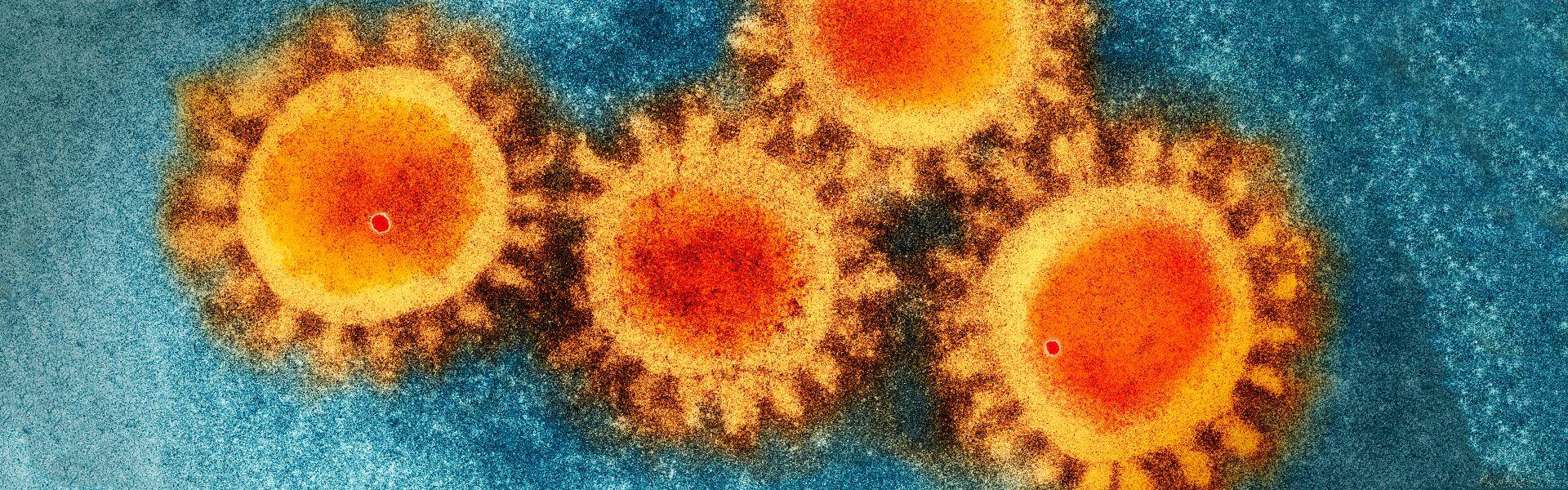 Coronavirus: ¿cómo el sistema inmunológico ataca al COVID-19?