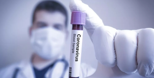 Colombia es el cuarto país sudamericano más afectado por el Coronavirus