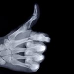 Esta nueva tecnología puede detectar rayos X con más eficiencia