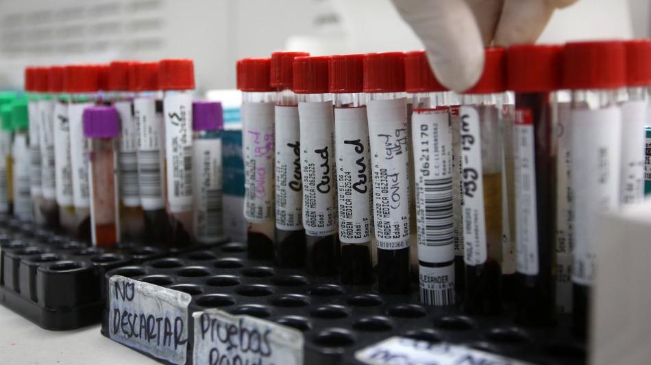 Colombia hoy: casos de contagios, muertes y recuperados de coronavirus, últimas noticias - Salud