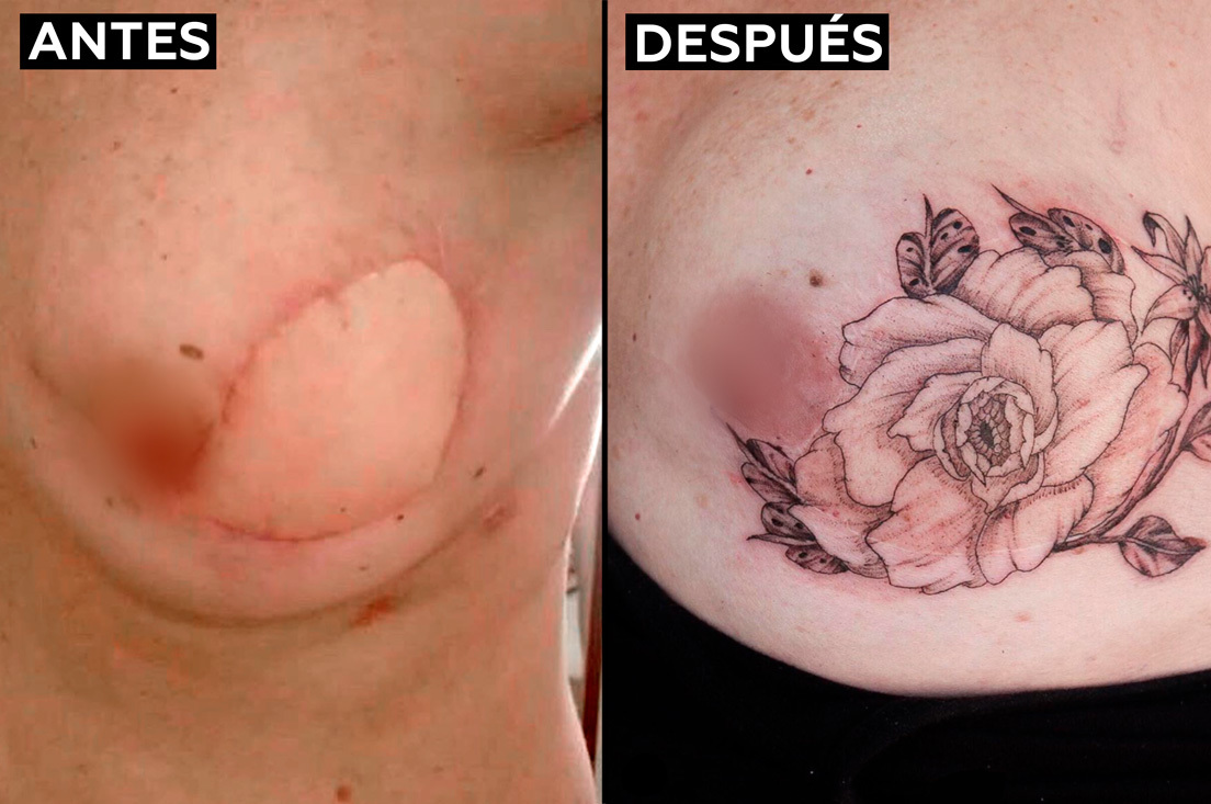 "Cubrir cicatrices y aumentar la autoestima": Una madre y su hijo viajan en un estudio móvil para tatuar a mujeres que tuvieron cáncer de mama (VIDEO)