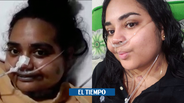 Coronavirus en Cartagena: Delfina Polo, doctora tuvo que aprender a hablar tras contraer covid 19 - Gente - Cultura