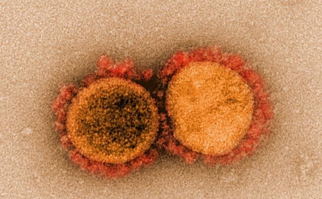 La vacunación después de la infección por SARS-CoV-2 vinculada a una disminución de los síntomas prolongados de COVID | Noticias de Buenaventura, Colombia y el Mundo