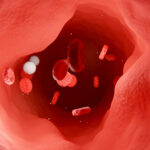 Las células T Haywire atacan la proteína en "malo" colesterol | Noticias de Buenaventura, Colombia y el Mundo