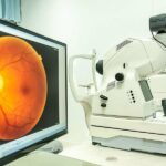 Grosor de la capa retinal relacionado con el deterioro cognitivo en adultos mayores | Noticias de Buenaventura, Colombia y el Mundo