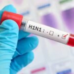 ¿Está comenzando la temporada de gripe porcina? ¿Quién está en riesgo de infección? Todo lo que necesitas saber | Noticias de Buenaventura, Colombia y el Mundo
