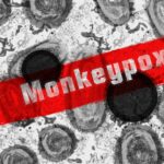 El brote de viruela del mono se puede contener, dice la Casa Blanca | Noticias de Buenaventura, Colombia y el Mundo
