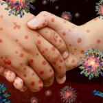 Viruela del mono, dengue y más: aumentan los brotes de enfermedades en la India | Noticias de Buenaventura, Colombia y el Mundo
