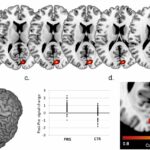 Hallan evidencia de cambios estructurales en el cerebro durante el embarazo | Noticias de Buenaventura, Colombia y el Mundo