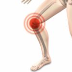 Los anestésicos que bloquean los nervios alrededor de la rodilla alivian el dolor en pacientes con artrosis de rodilla | Noticias de Buenaventura, Colombia y el Mundo