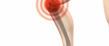 Los anestésicos que bloquean los nervios alrededor de la rodilla alivian el dolor en pacientes con artrosis de rodilla | Noticias de Buenaventura, Colombia y el Mundo