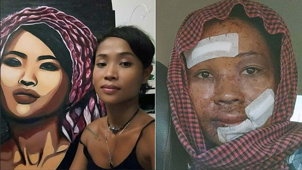 Agredido con cuchillos y ácido, artista camboyano pide la detención de 2 agresores | Noticias de Buenaventura, Colombia y el Mundo