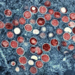 EE.UU. planea poner fin a la emergencia de salud pública de mpox en enero | Noticias de Buenaventura, Colombia y el Mundo