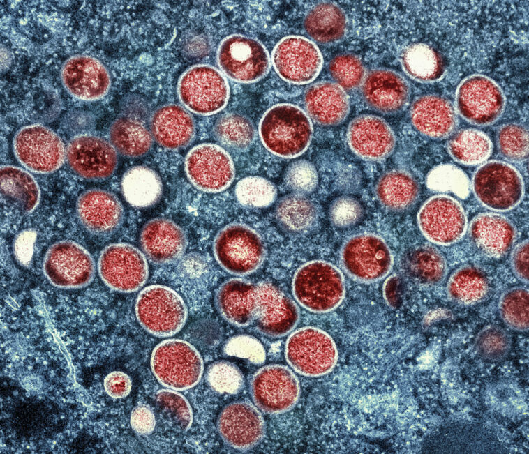 EE.UU. planea poner fin a la emergencia de salud pública de mpox en enero | Noticias de Buenaventura, Colombia y el Mundo