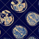 Se observa un 'adelgazamiento' cerebral similar en adultos mayores con obesidad y personas con Alzheimer | Noticias de Buenaventura, Colombia y el Mundo