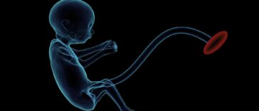 Ajuste de carrera de descenso para pruebas prenatales de AFP, insta un estudio | Noticias de Buenaventura, Colombia y el Mundo