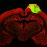 Lesiones cerebrales de rata 'conectadas' con minicerebros humanos cultivados en laboratorio en el primer experimento mundial | Noticias de Buenaventura, Colombia y el Mundo