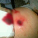 Herido chofer de ‘mula’ en atraco