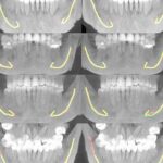 La inteligencia artificial ayuda en el cuidado dental y la cirugía de la mandíbula | Noticias de Buenaventura, Colombia y el Mundo