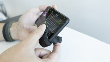 El accesorio de teléfono inteligente de muy bajo costo lleva el control de la presión arterial al alcance de su mano | Noticias de Buenaventura, Colombia y el Mundo